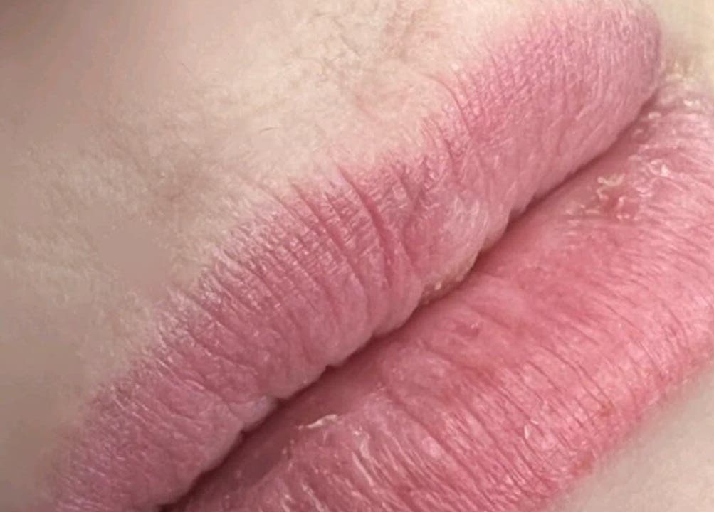 Close-up of beautifully enhanced lips showcasing Nila Brows' expertise in Melbourne, Victoria, AU.