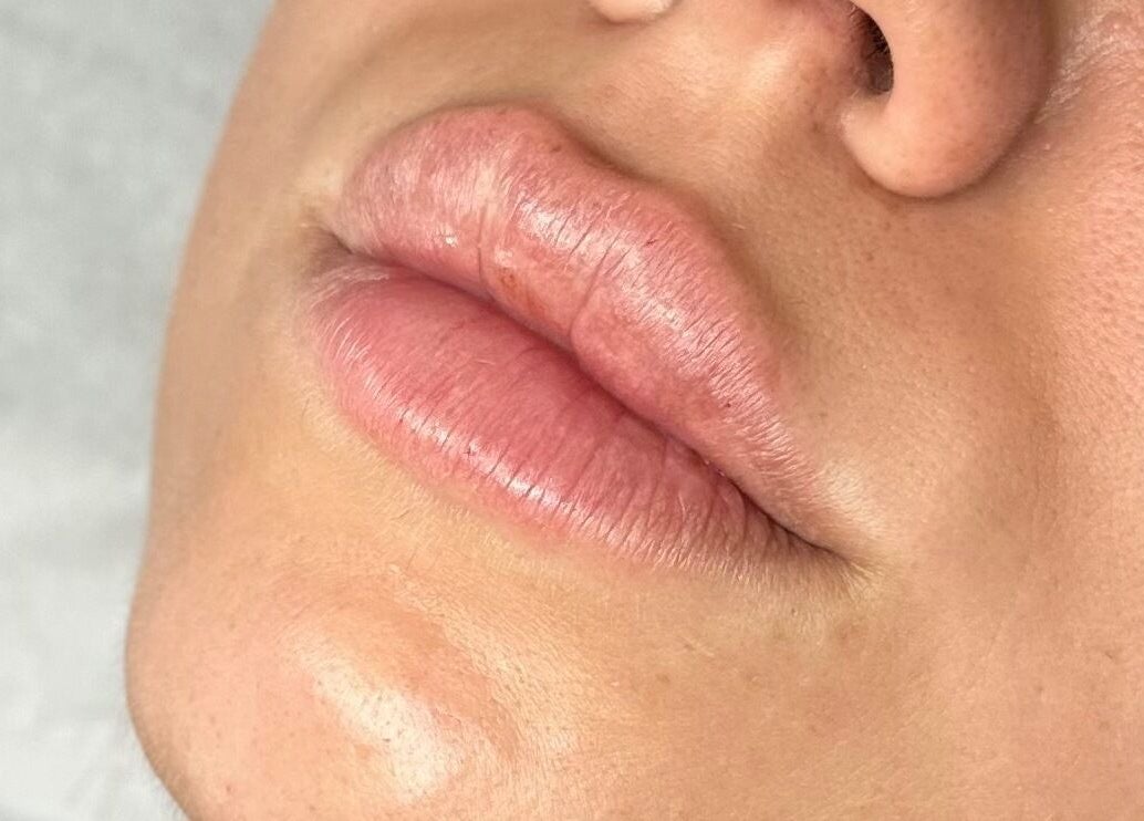 Close-up of lips at Sage beauty & aesthetics (former JJ Beauty), Wigan, England, GB.