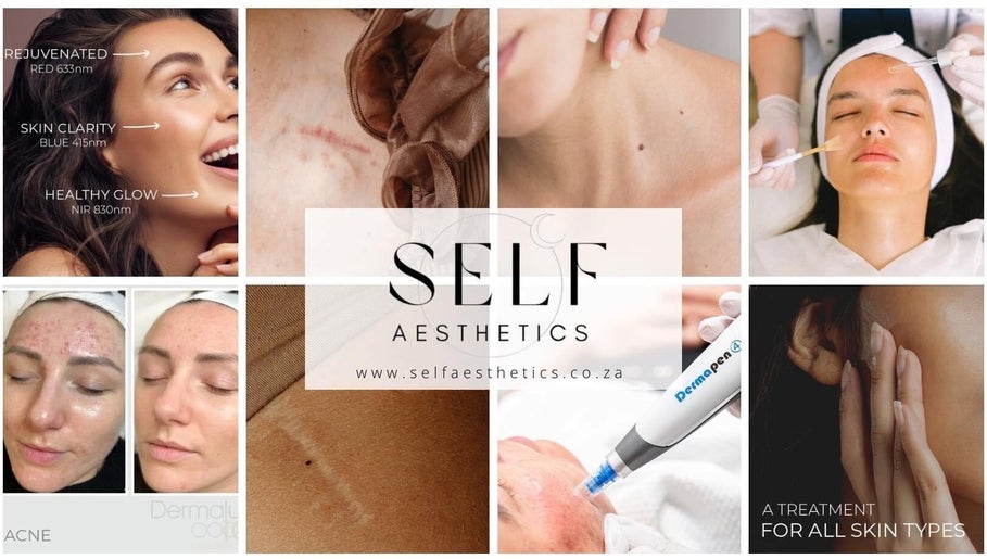 Self Aesthetics - Medical Aesthetics & Wound Healing – kuva 1