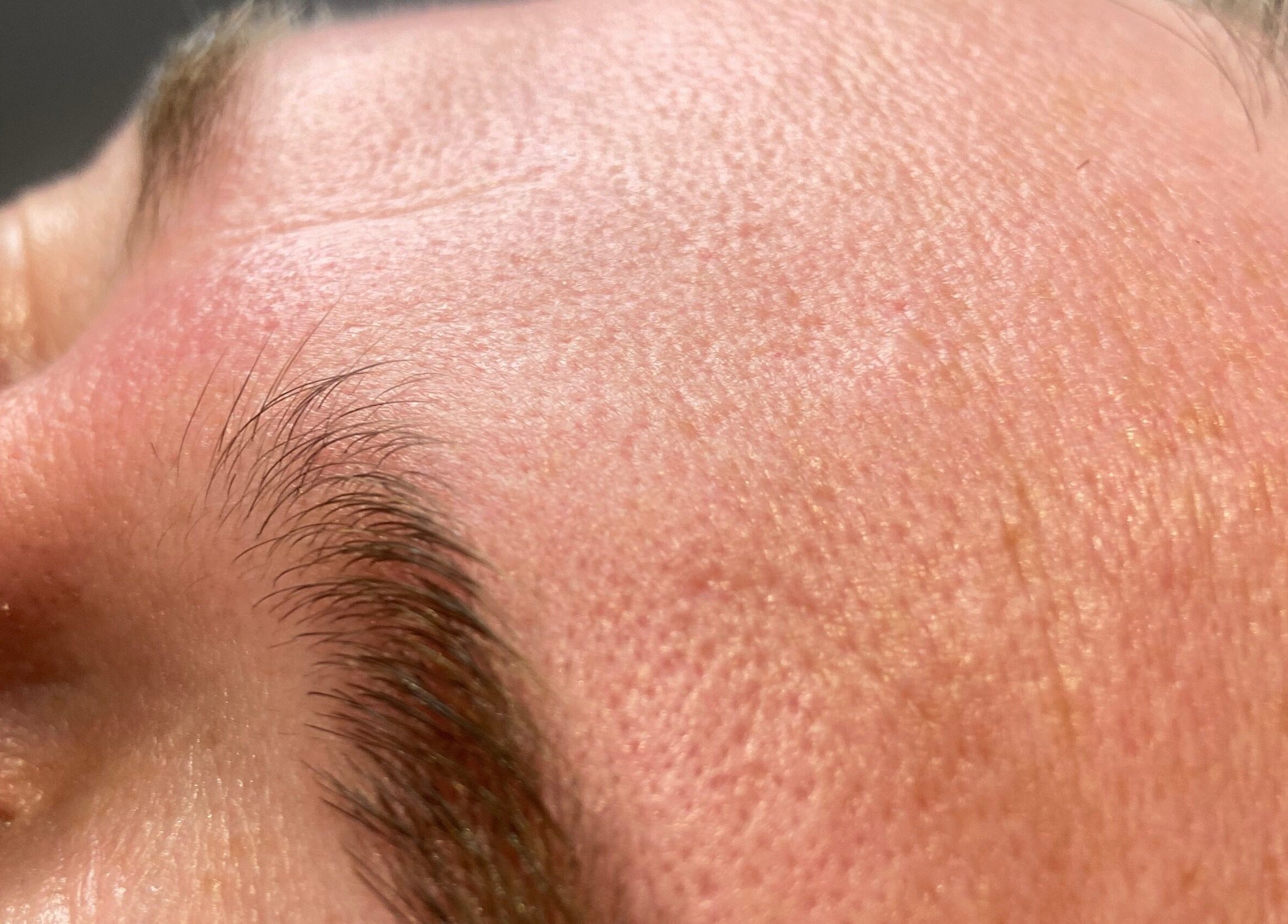 Close-up of a smooth forehead post-treatment at Simply Wax, Ballyclare, Northern Ireland, GB.