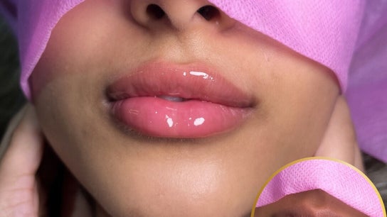 Skin Scense Clinic