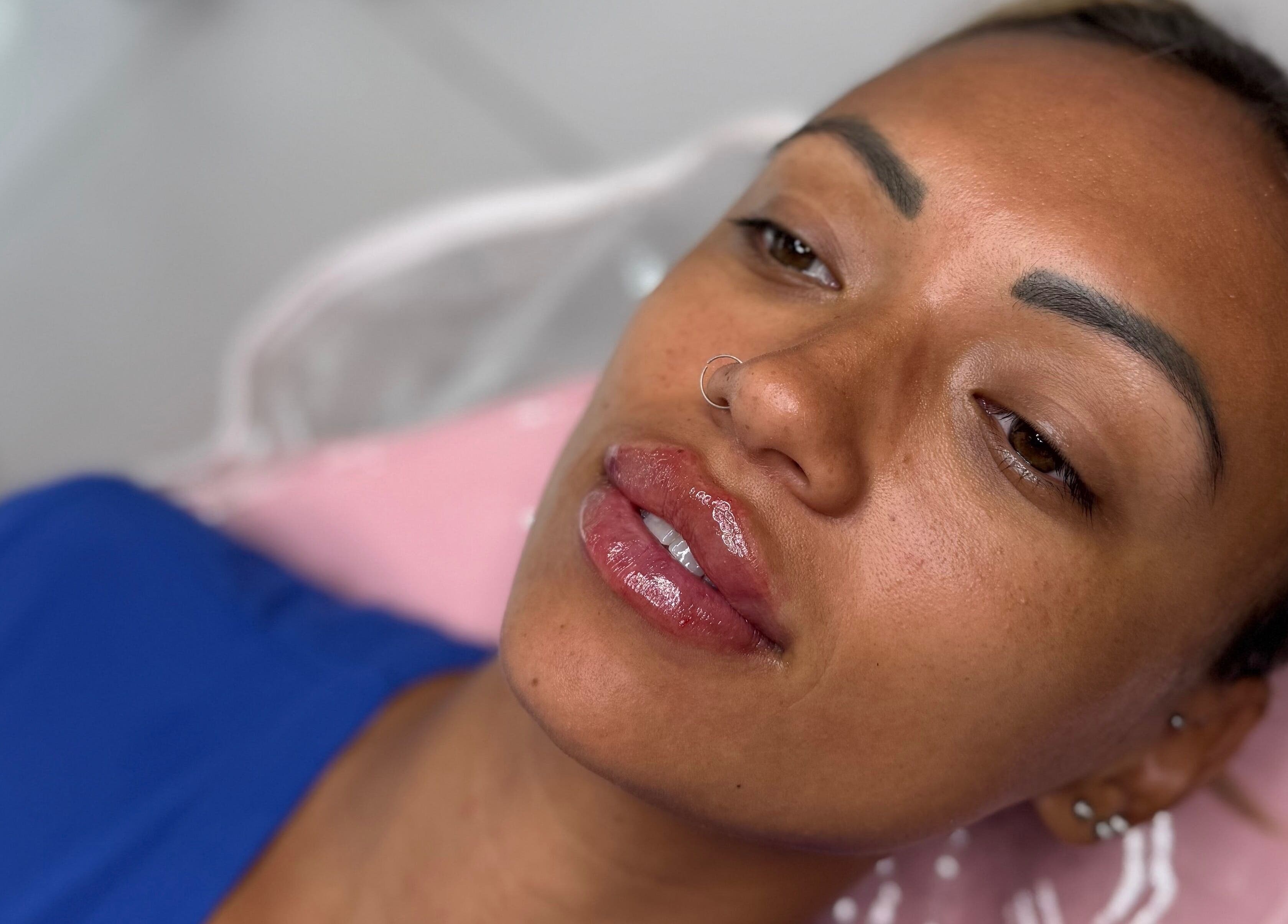 Aesthetic treatment at Aesthetics by Danielle, Glasgow, Scotland, GB, highlighting smooth skin and enhanced lips.