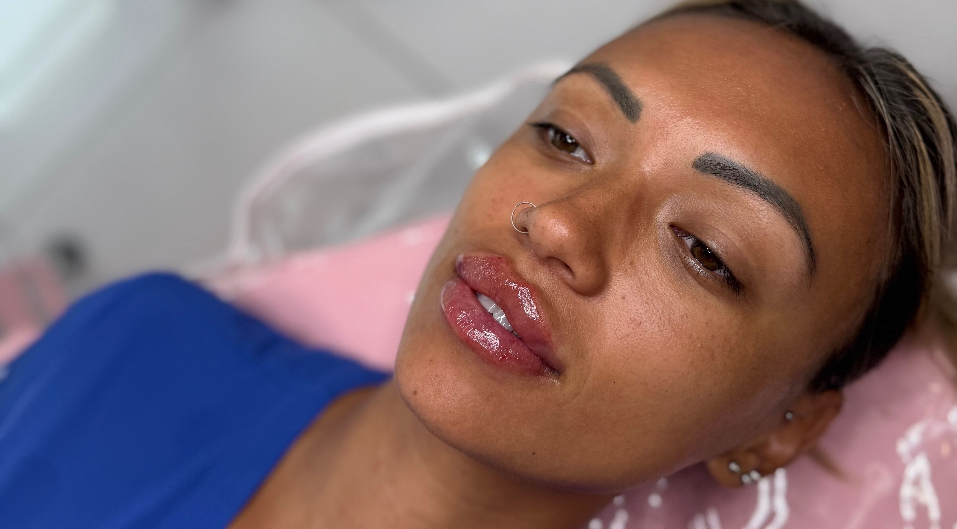 Aesthetic treatment at Aesthetics by Danielle, Glasgow, Scotland, GB, highlighting smooth skin and enhanced lips.