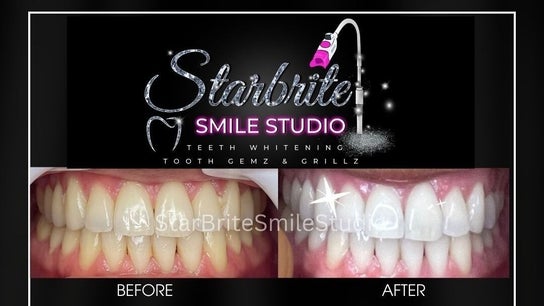 StarBrite Smile Studio