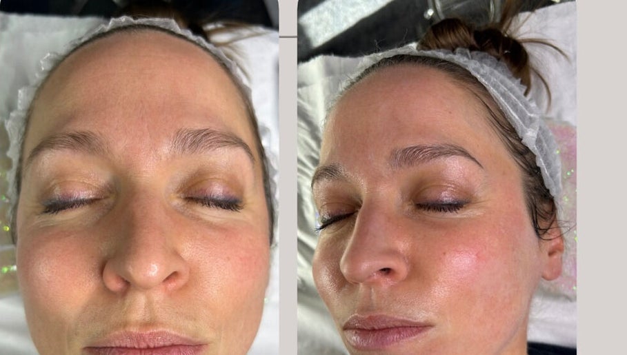Close-up of a rejuvenated face post-treatment at Secret Skin Beauty, Fontwell, England, GB.