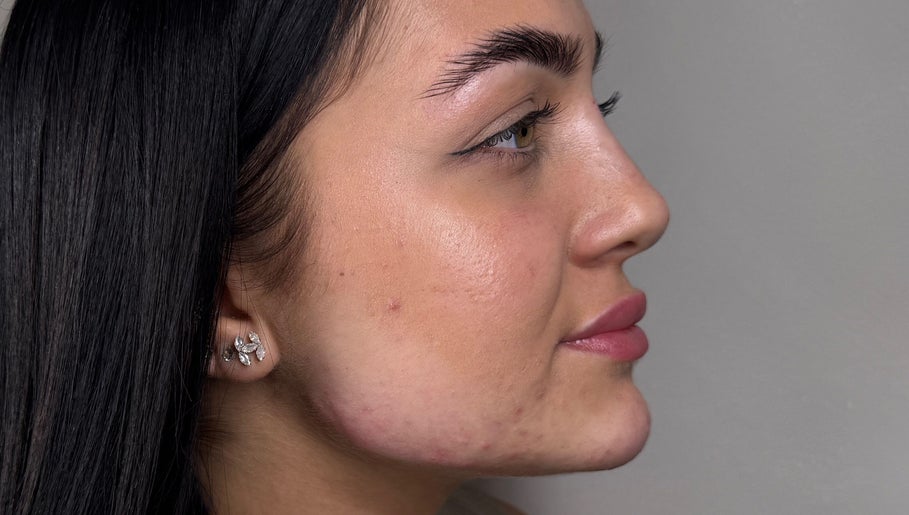 Close-up of a serene face with glowing skin at Paradox Aesthetics, Worcester, England, GB.