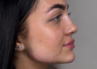 Close-up of a serene face with glowing skin at Paradox Aesthetics, Worcester, England, GB.