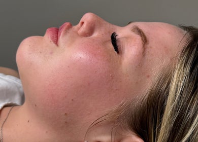 Close-up of a relaxed face showcasing glowing skin at Paradox Aesthetics, Worcester, England, GB.