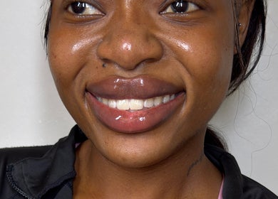 Close-up of a smiling client at Paradox Aesthetics, Worcester, England, GB showcasing glossy, healthy lips.