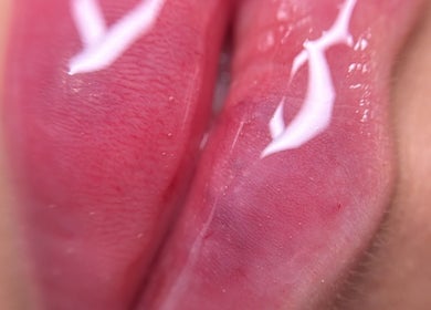 Close-up of glossy pink lips at Paradox Aesthetics, Worcester, England, GB showcasing treatment results.