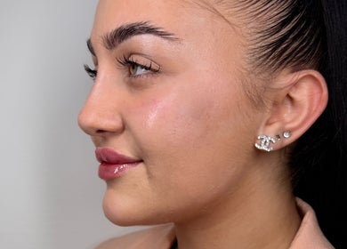 Close-up of a woman's radiant skin and earrings at Paradox Aesthetics, Worcester, England, GB.