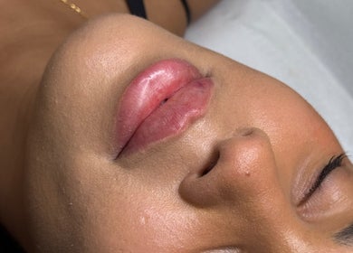 Close-up of enhanced lips at Paradox Aesthetics, Worcester, England, GB showcasing beauty treatment.