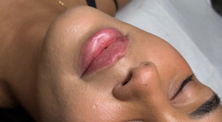 Close-up of enhanced lips at Paradox Aesthetics, Worcester, England, GB showcasing beauty treatment.