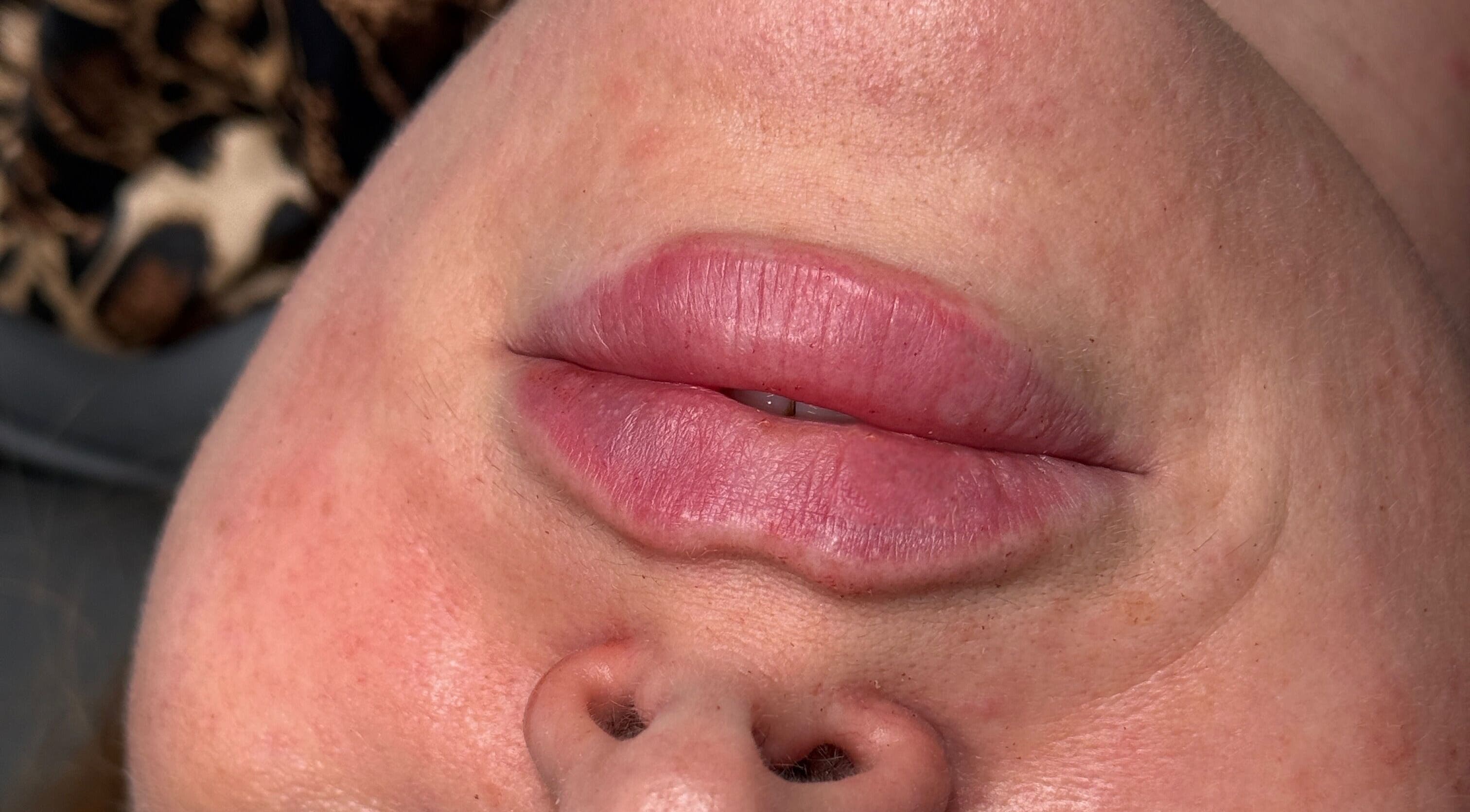 Close-up of enhanced lips at Paradox Aesthetics, Worcester, England, GB.