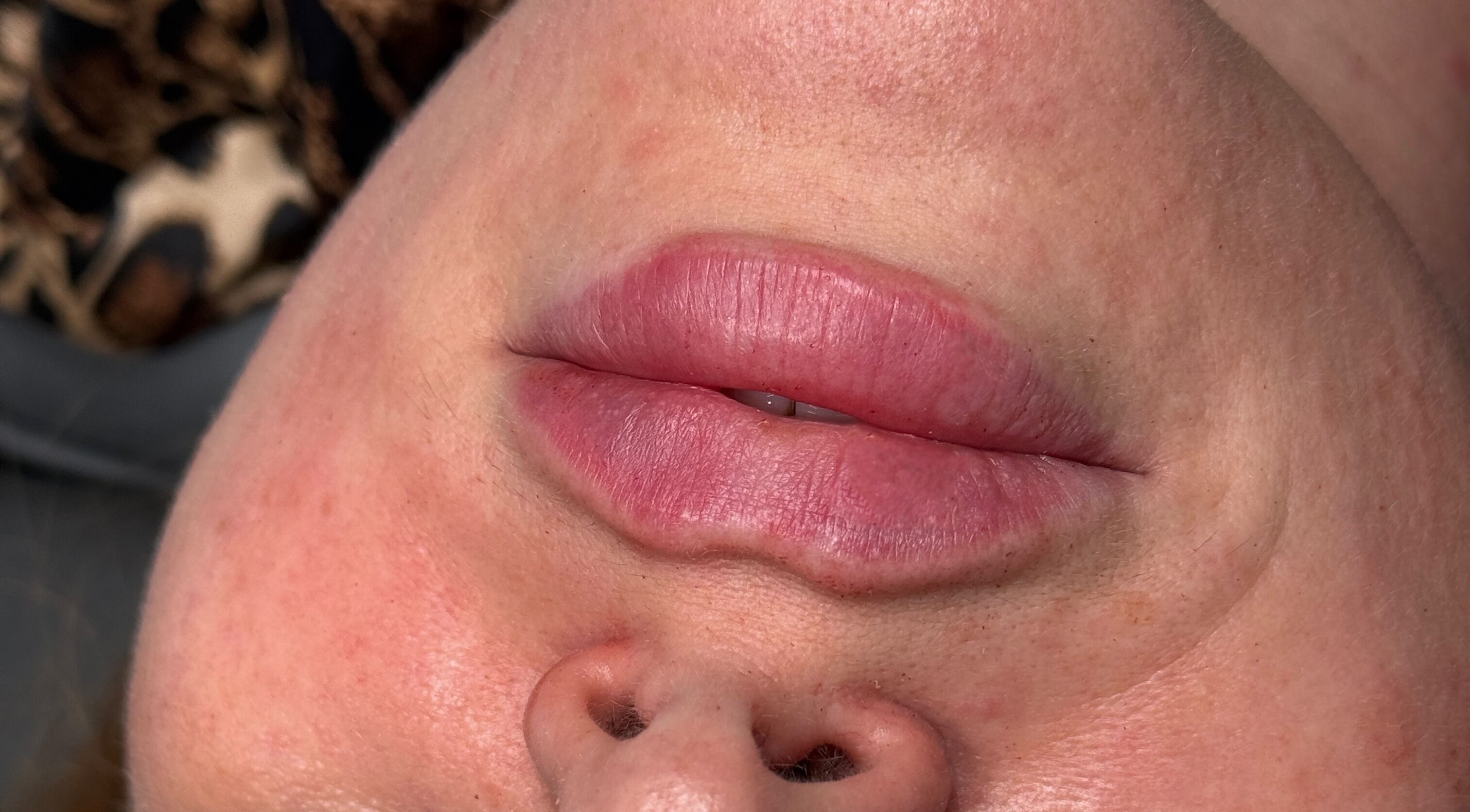 Close-up of enhanced lips at Paradox Aesthetics, Worcester, England, GB.