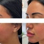 Angel Face Clinics - Redcliffe