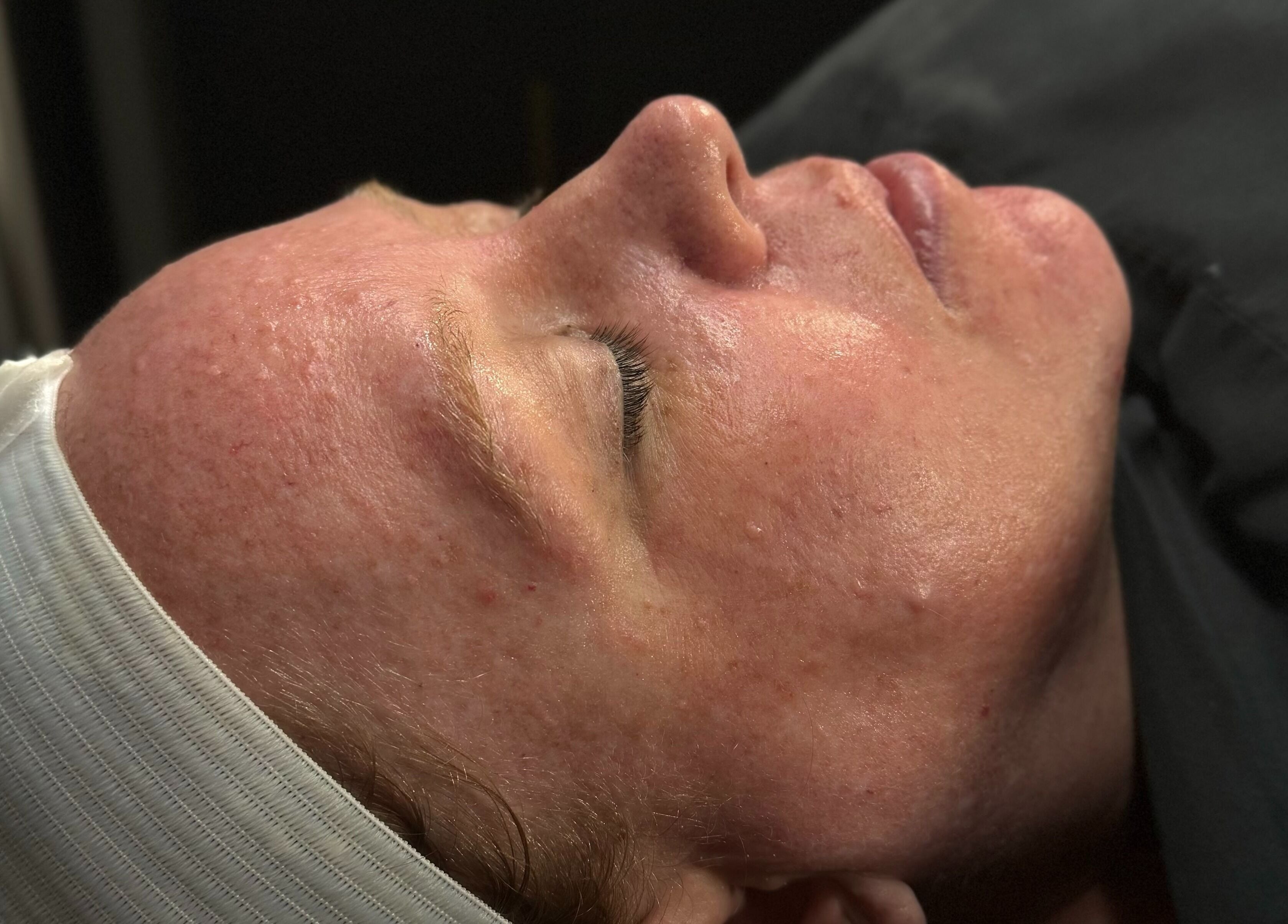 Client enjoying facial treatment at Wild Winx Esthetics, Phoenix, Arizona, US.