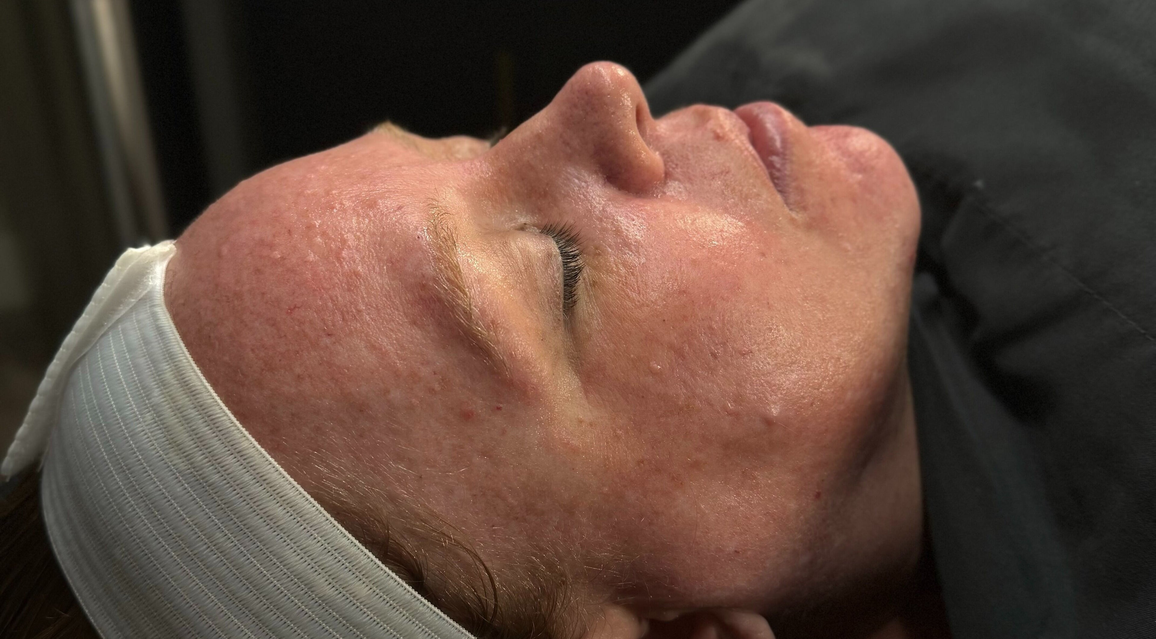 Client enjoying facial treatment at Wild Winx Esthetics, Phoenix, Arizona, US.