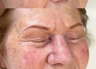 Before and after image of eyebrow enhancement at Alexandra Beauty in Norwich, England, GB.