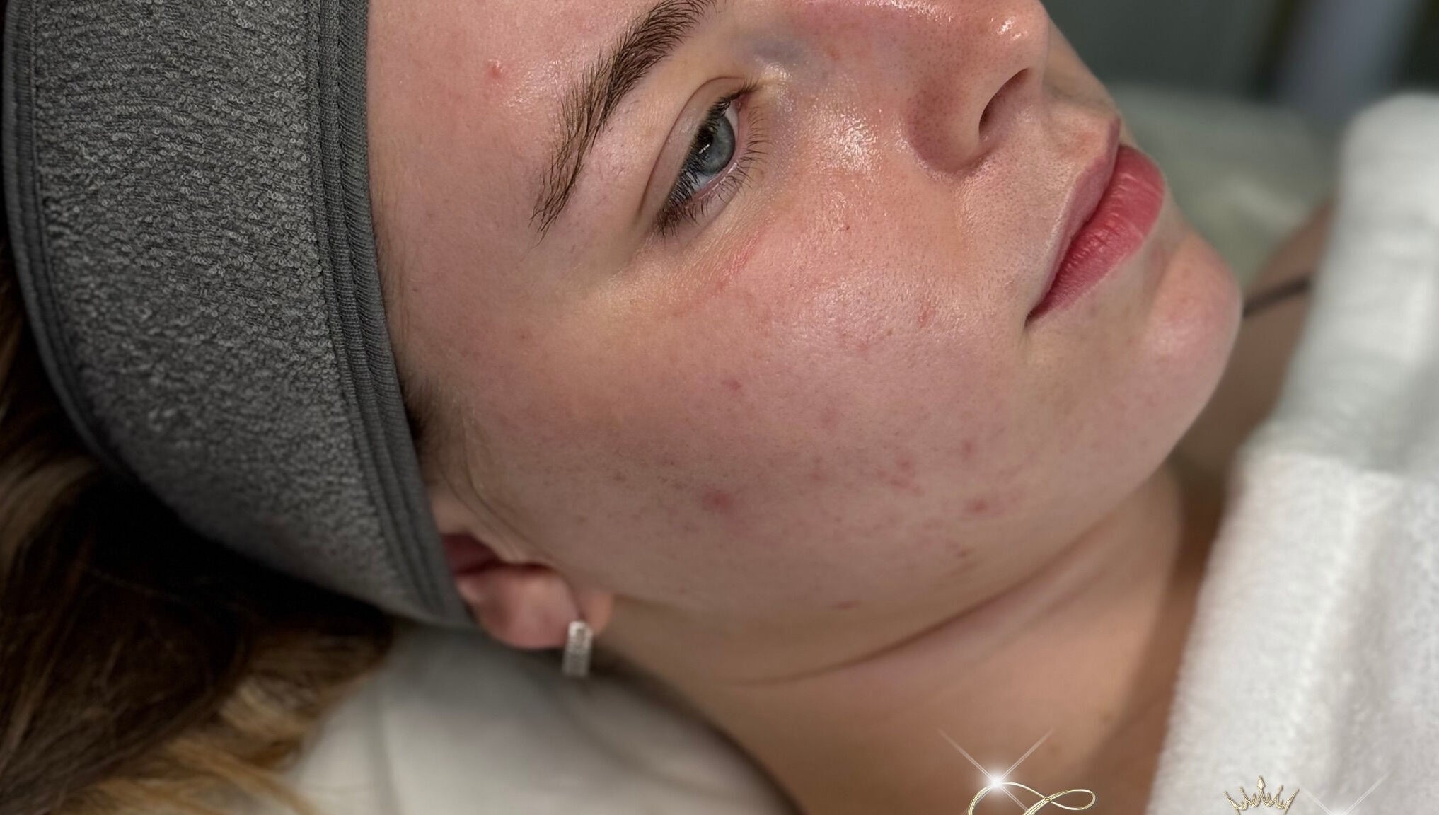 Relaxed woman receiving skincare treatment at Glamour Empire, Hull, England, GB. Focus on serene facial experience.