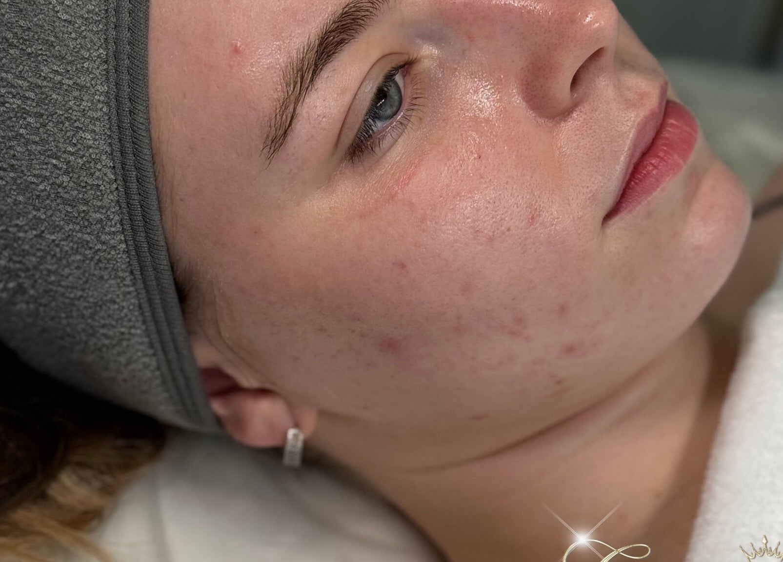 Relaxed woman receiving skincare treatment at Glamour Empire, Hull, England, GB. Focus on serene facial experience.