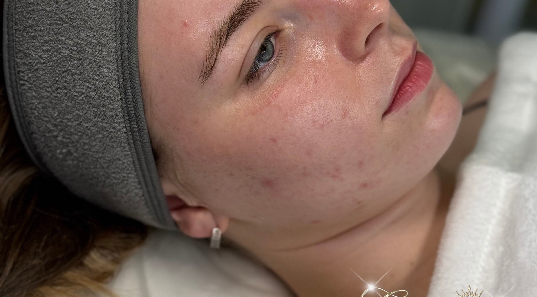 Relaxed woman receiving skincare treatment at Glamour Empire, Hull, England, GB. Focus on serene facial experience.
