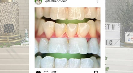 Εικόνα Teeth and Tonic Teeth Whitening 2
