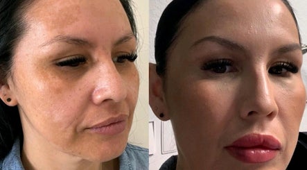 CONROE, TX - Identity Aesthetics offers transformative skincare in Conroe, Texas, US with remarkable results.