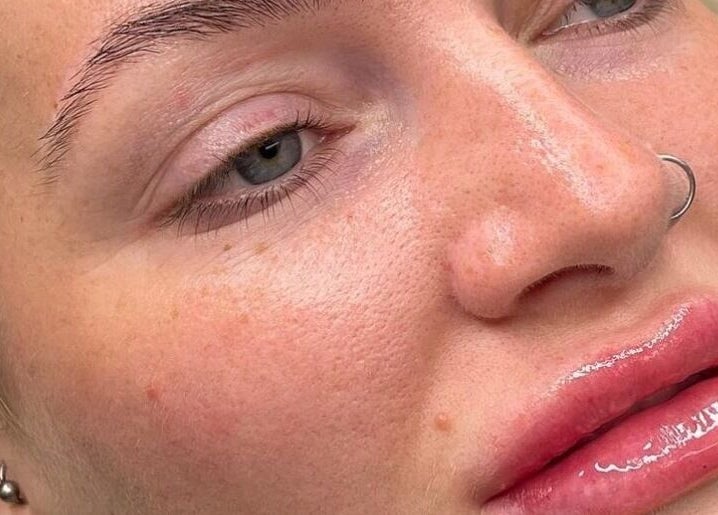 Close-up of glowing skin after treatment at Natural+ in Hapton, England, GB, showcasing flawless beauty.