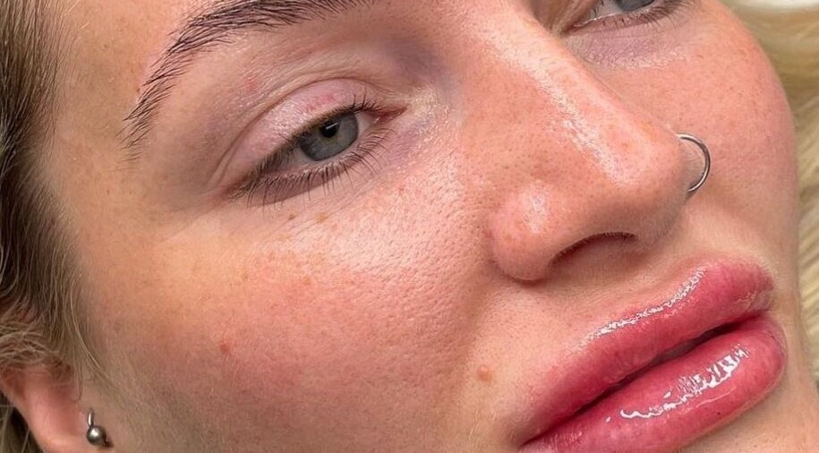 Close-up of glowing skin after treatment at Natural+ in Hapton, England, GB, showcasing flawless beauty.