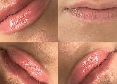 Close-up of glossy lips before and after treatment at The Sculpt Squad, Caterham, England, GB.