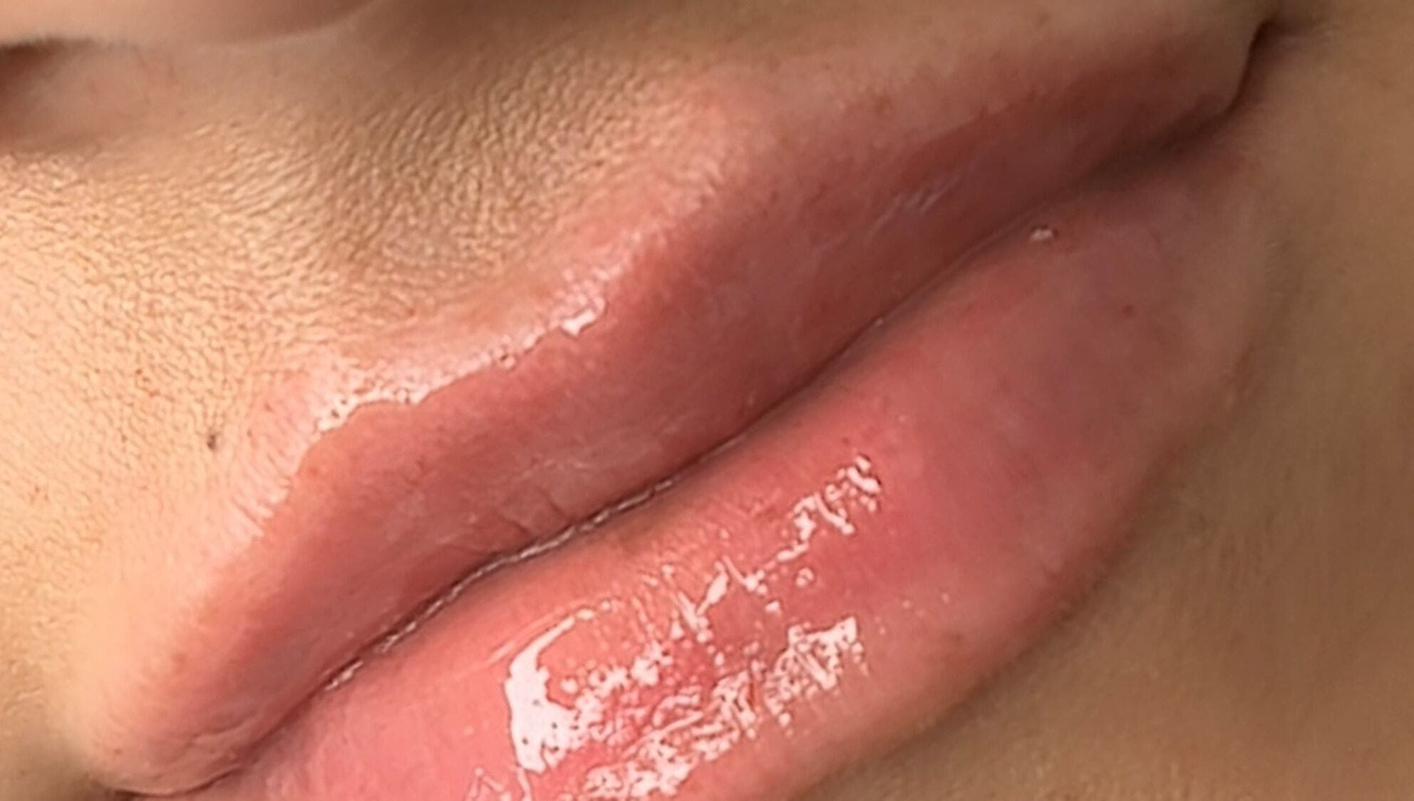 Close-up of glossy lips treated at The Sculpt Squad in Caterham, England, GB. Enhancing natural beauty with expert care.