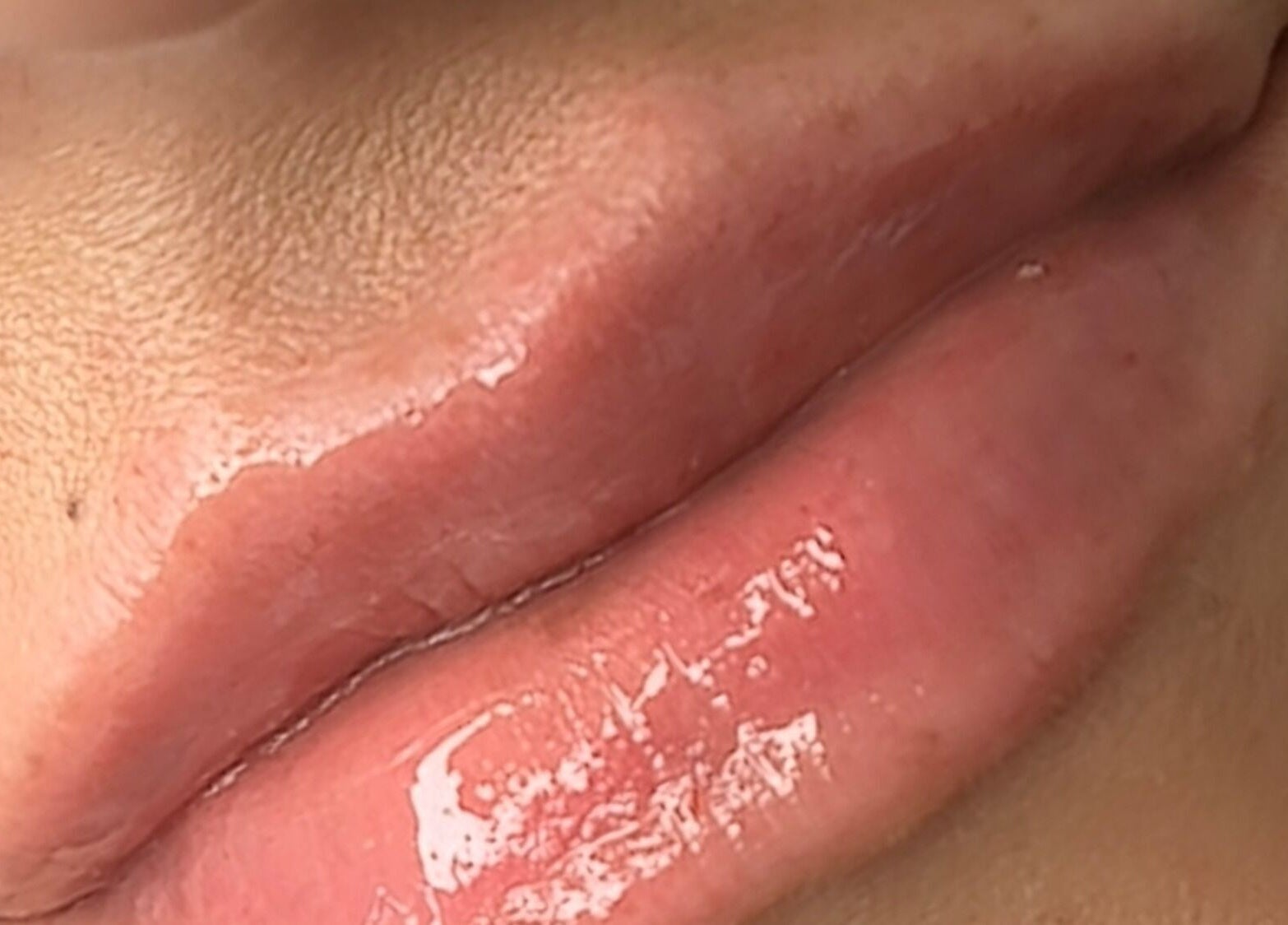 Close-up of glossy lips treated at The Sculpt Squad in Caterham, England, GB. Enhancing natural beauty with expert care.