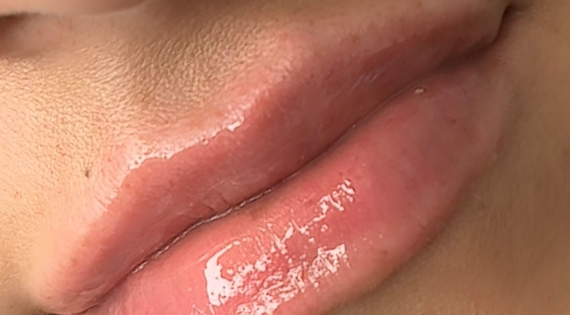 Close-up of glossy lips treated at The Sculpt Squad in Caterham, England, GB. Enhancing natural beauty with expert care.