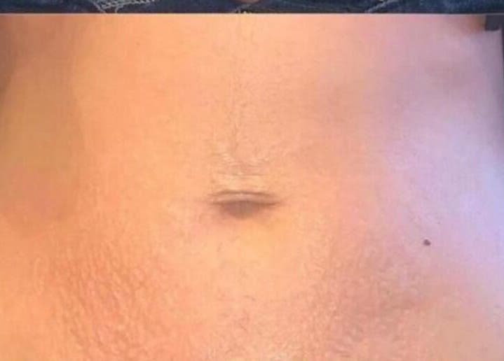 Close-up of radiant skin care results at The Sculpt Squad, Caterham, England, GB.