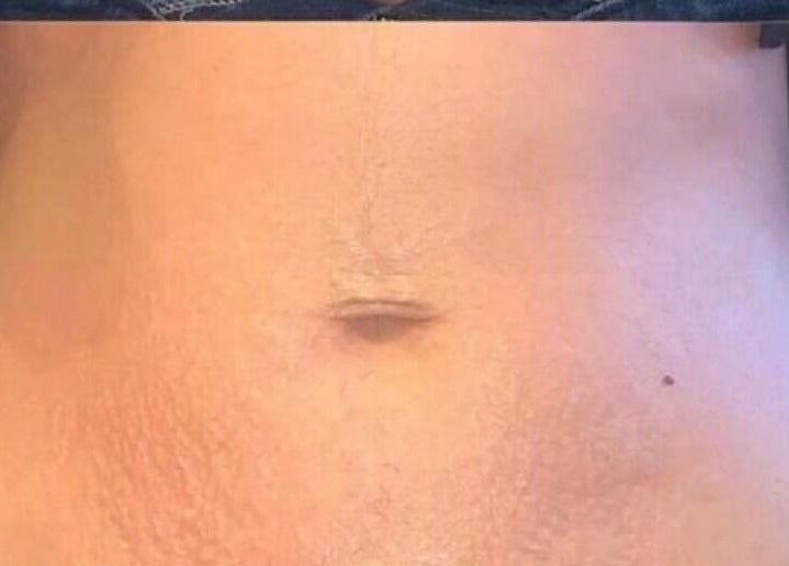 Close-up of radiant skin care results at The Sculpt Squad, Caterham, England, GB.