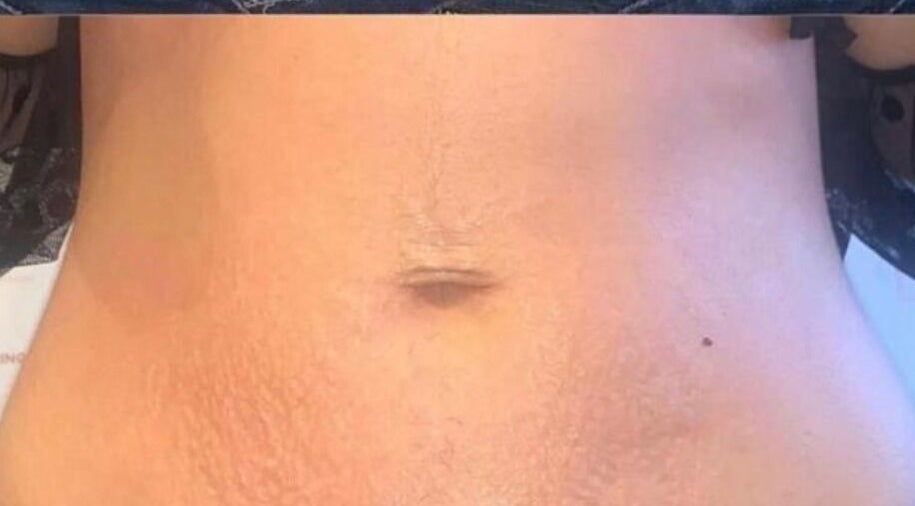 Close-up of radiant skin care results at The Sculpt Squad, Caterham, England, GB.