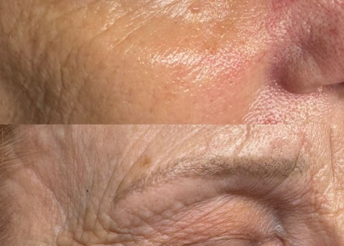Detailed skin texture example at Aesthetics with Lily - Long Buckby, Long Buckby, England, GB.