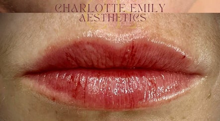 Charlotte Emily Aesthetics – kuva 3