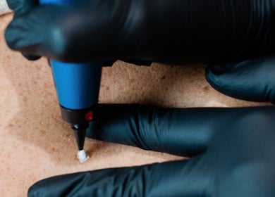 Close-up of skincare treatment at The Skin Studio, London, England, GB, highlighting expert care.