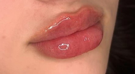 JP Luxe Aesthetics kép 2