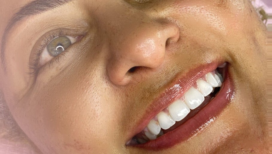 Cliente com sorriso resplandecente após tratamento na RM Brazilian Care, Amsterdam, Noord-Holland, NL.