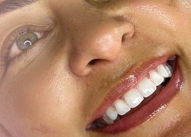 Cliente com sorriso resplandecente após tratamento na RM Brazilian Care, Amsterdam, Noord-Holland, NL.