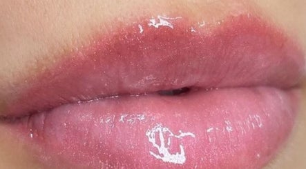 Brilho labial em RM Brazilian Care, Amsterdam, Noord-Holland, NL, destacando lábios radiantes.
