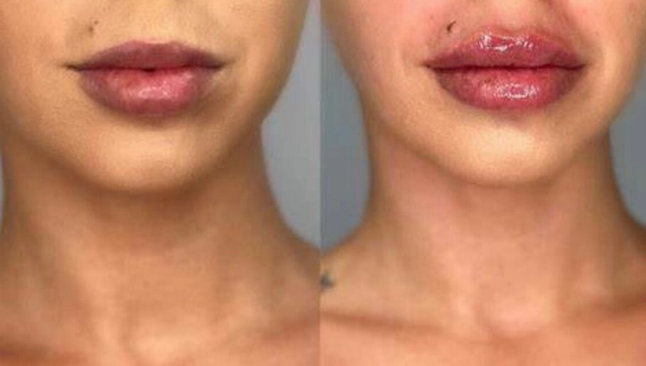 L’luxe Aesthetics image 1